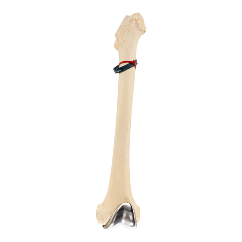 Real Human Femur - Pathology