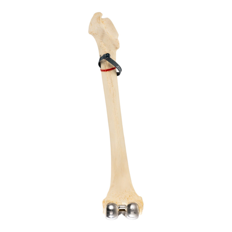 Real Human Femur - Pathology