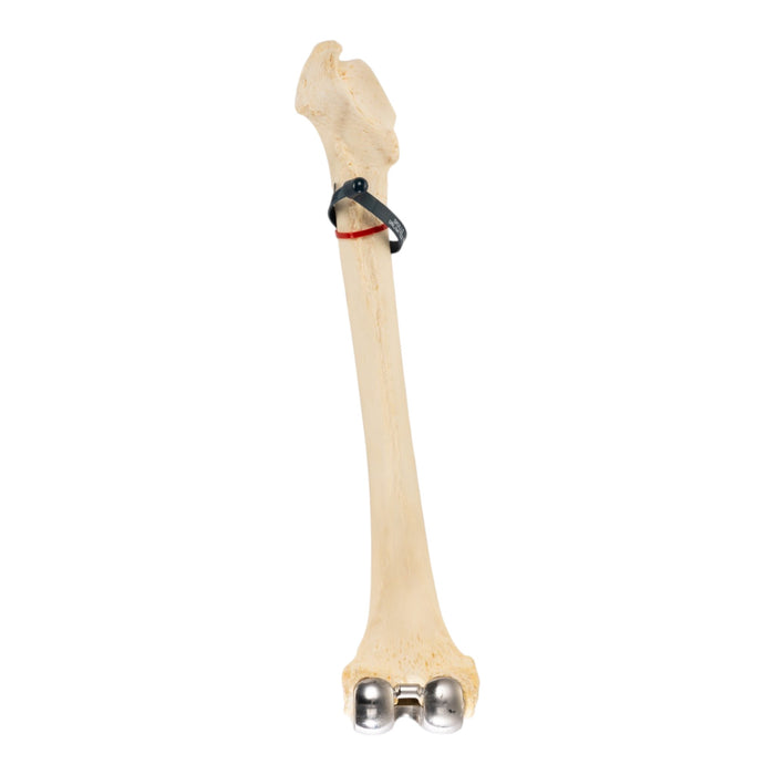 Real Human Femur - Pathology