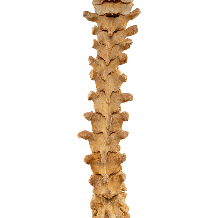 Real Human Spine - Loosely Strung