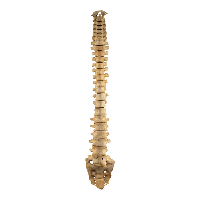 Real Human Spine and Sacrum - Loosely Strung