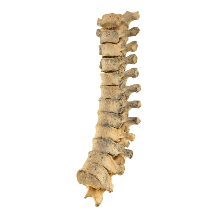 Real Human Thoracic Vertebrae Set - Loosely Strung