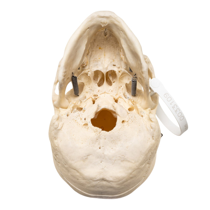 Real Human Skull