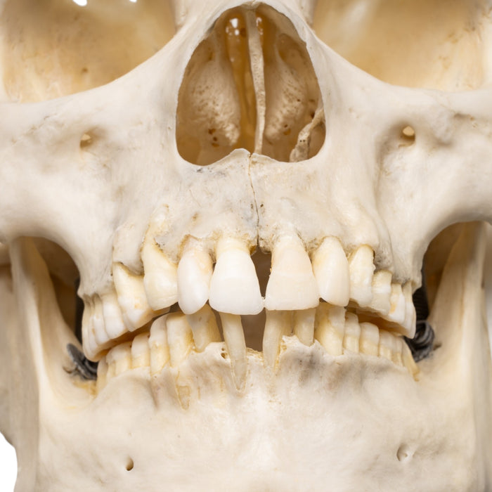 Real Human Skull