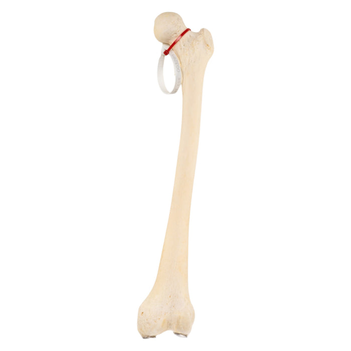 Real Human Femur - Pathology