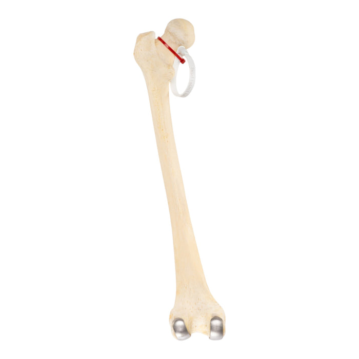 Real Human Femur - Pathology