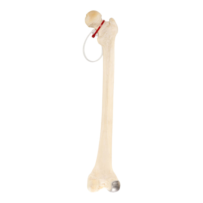 Real Human Femur - Pathology