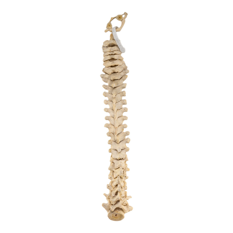 Real Human Spine - Loosely Strung