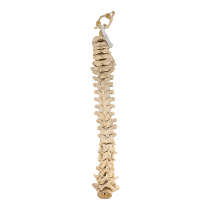 Real Human Spine - Loosely Strung