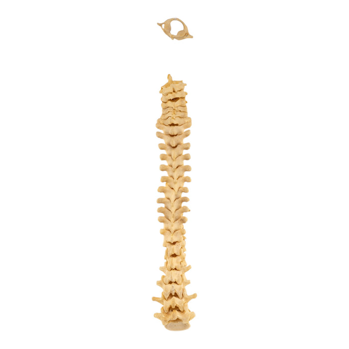 Real Human Spine - Loosely Strung