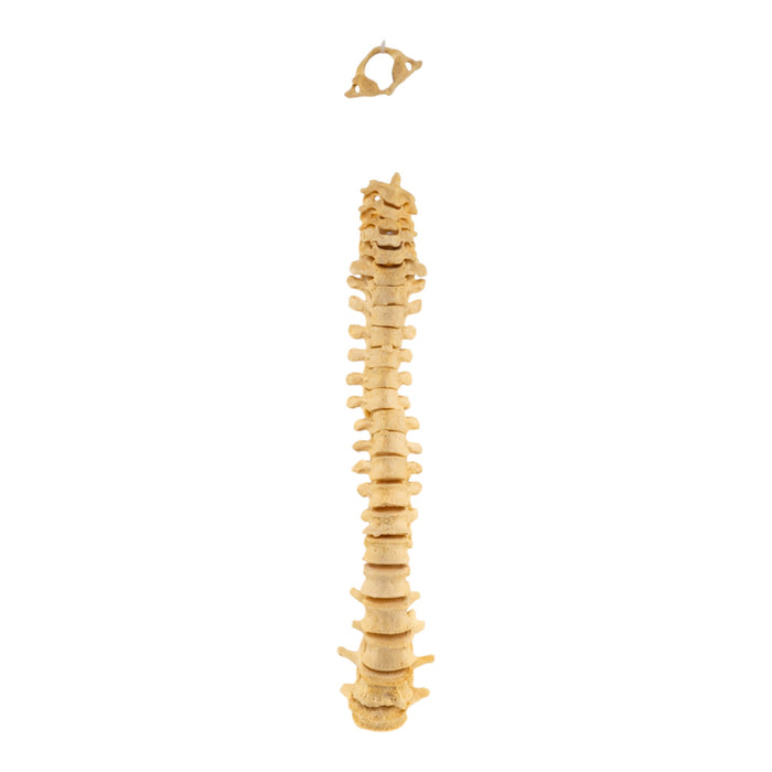 Real Human Spine - Loosely Strung
