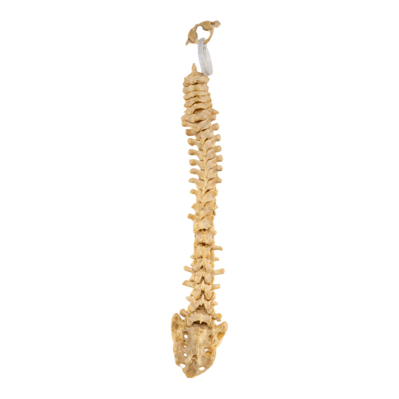 Real Human Spine - Loosely Strung
