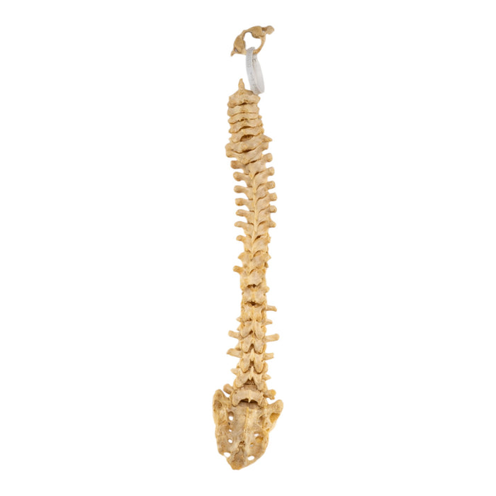 Real Human Spine - Loosely Strung