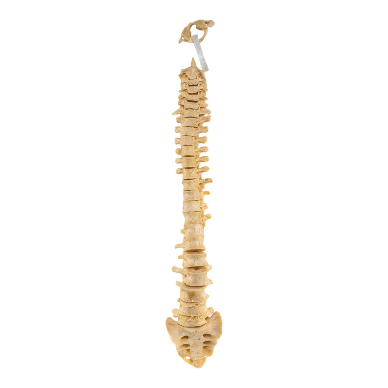 Real Human Spine - Loosely Strung