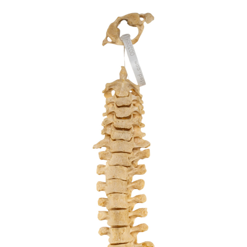 Real Human Spine - Loosely Strung