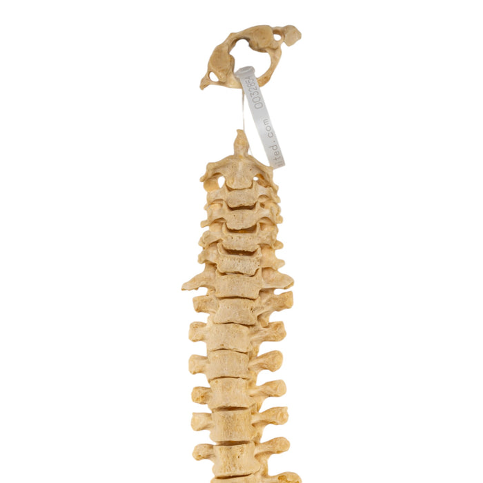 Real Human Spine - Loosely Strung