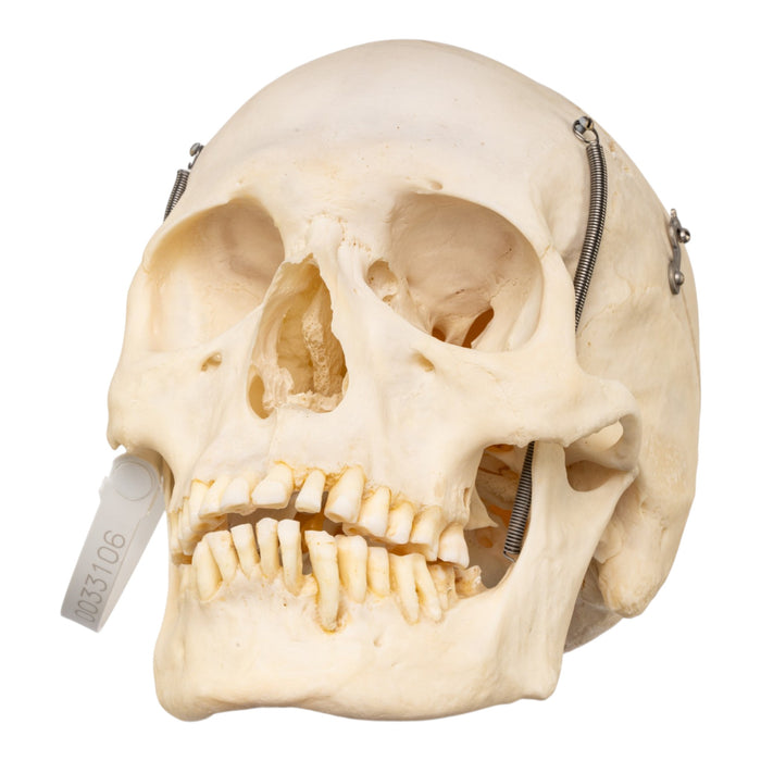 Real Human Skull