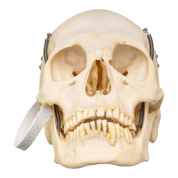 Real Human Skull