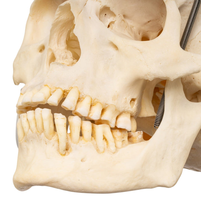 Real Human Skull