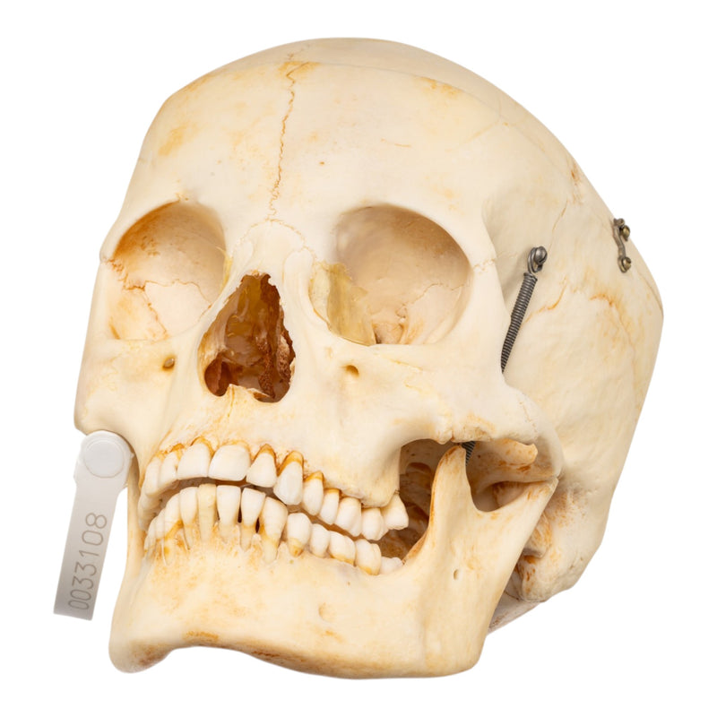 Real Human Skull