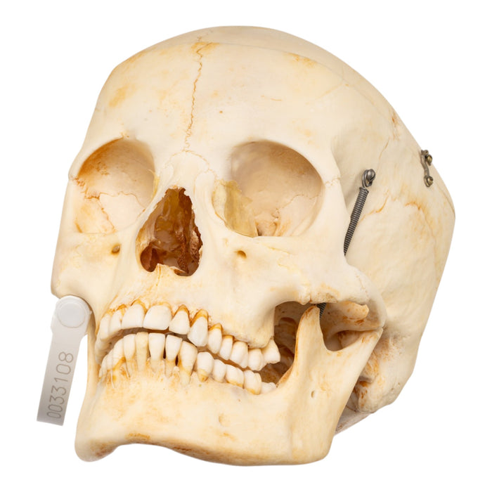 Real Human Skull
