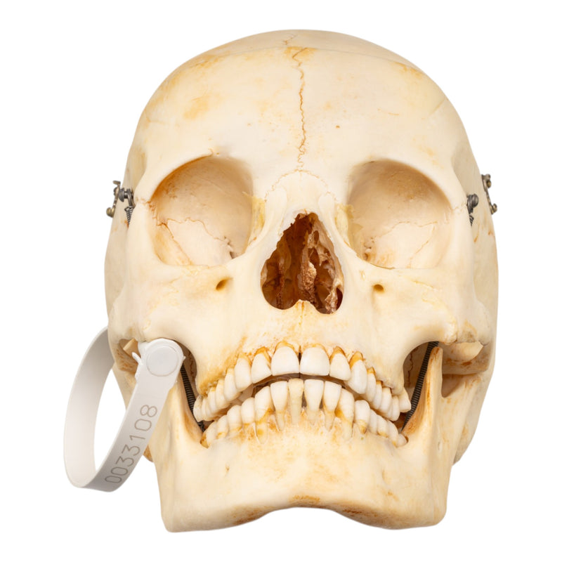 Real Human Skull