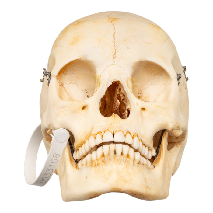 Real Human Skull