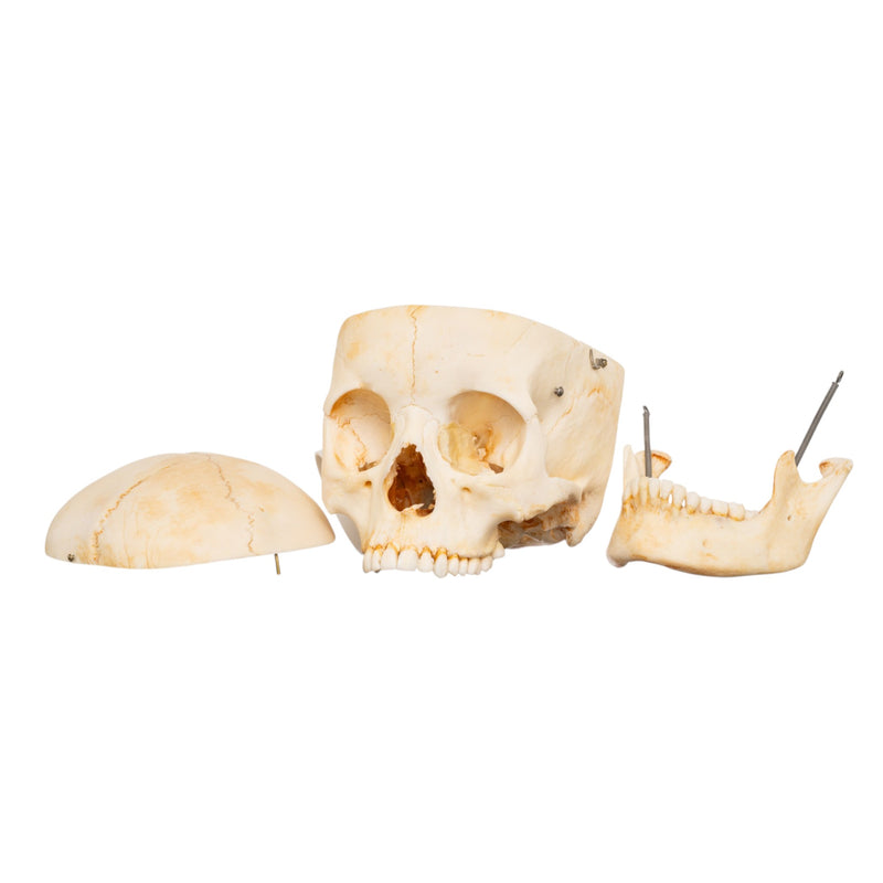 Real Human Skull