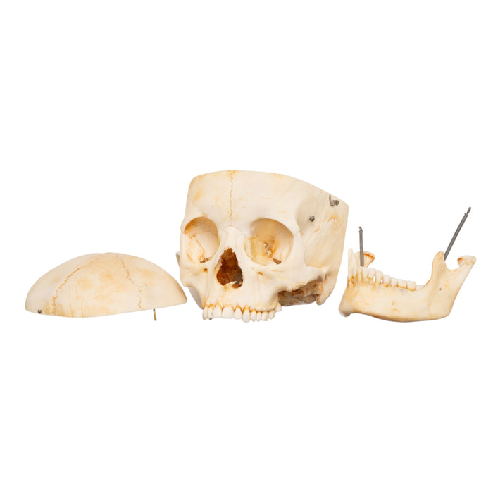 Real Human Skull