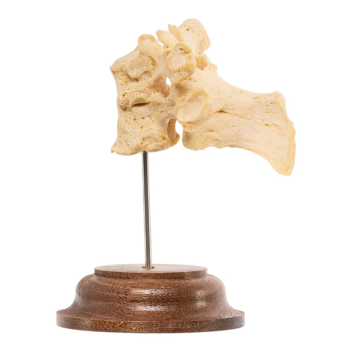 Real Human Thoracic Vertebrae - Fused