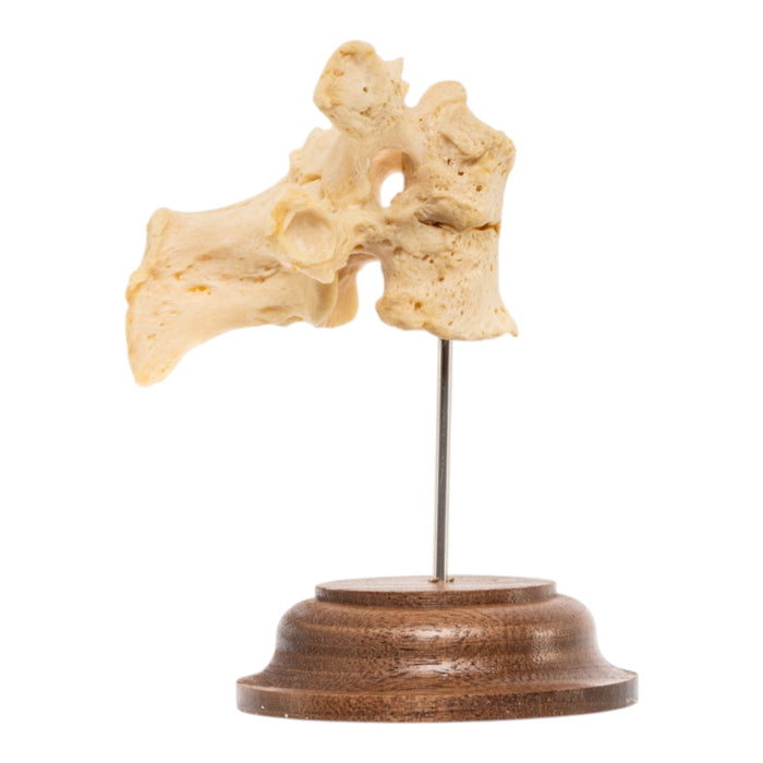 Real Human Thoracic Vertebrae - Fused