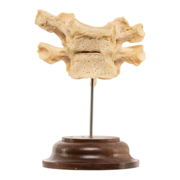 Real Human Thoracic Vertebrae - Fused