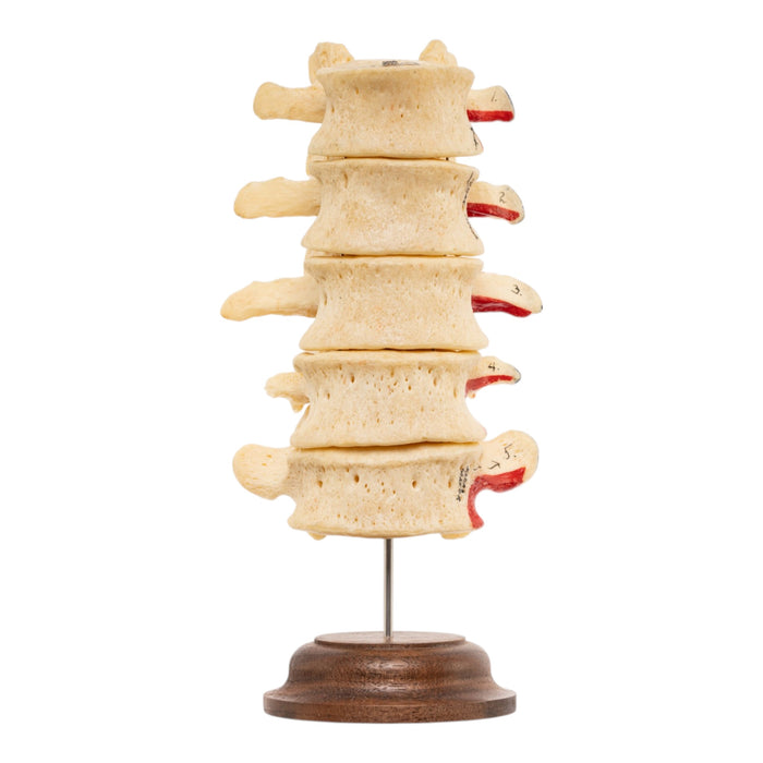 Real Human Lumbar Vertebrae - Painted