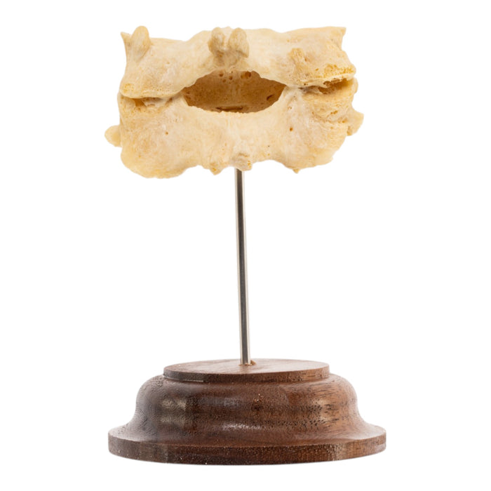Real Human Cervical Vertebrae - Fused