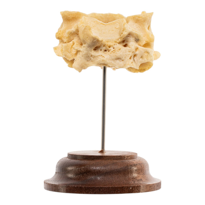 Real Human Cervical Vertebrae - Fused