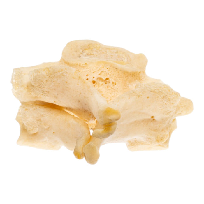 Real Human Cervical Vertebrae - Fused