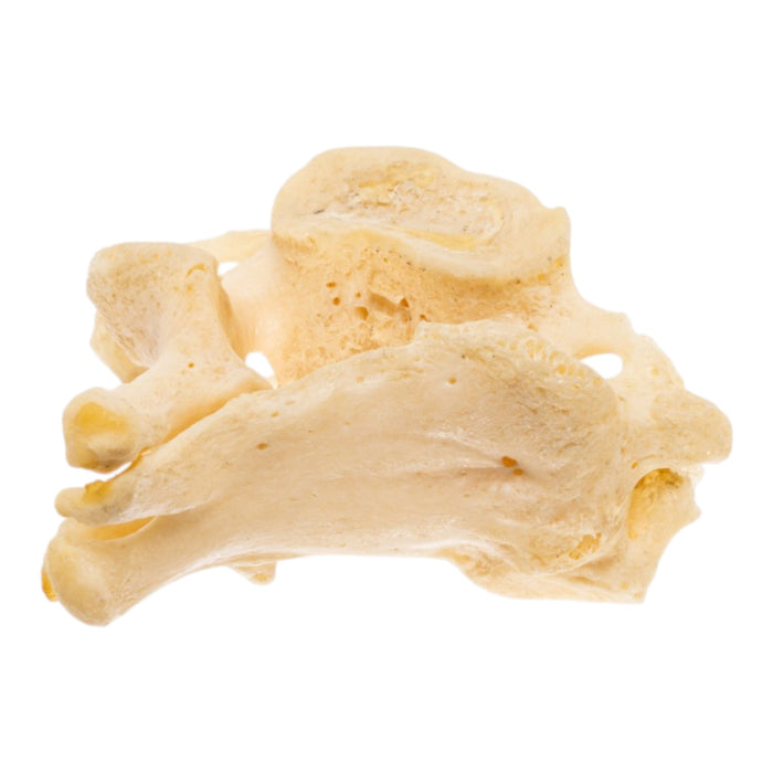 Real Human Cervical Vertebrae - Fused
