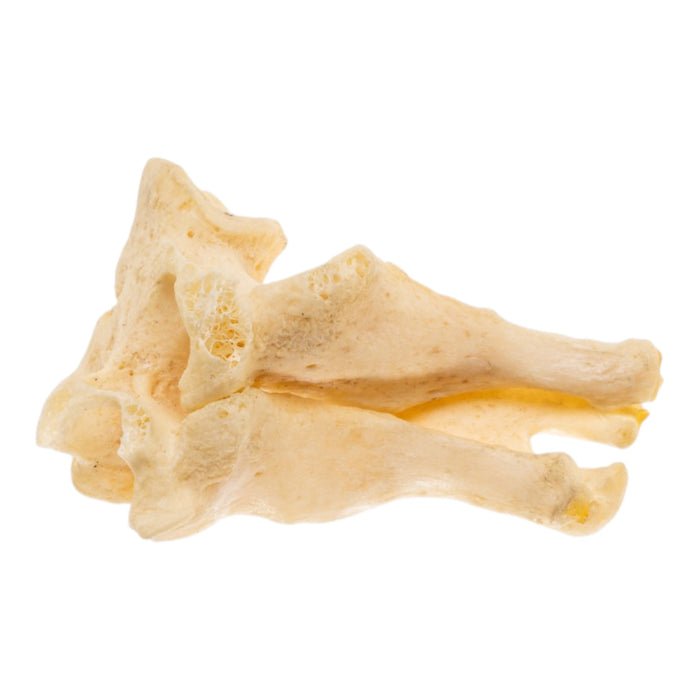 Real Human Cervical Vertebrae - Fused
