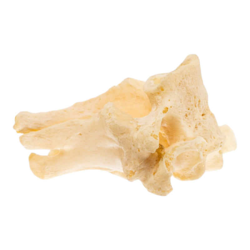 Real Human Cervical Vertebrae - Fused