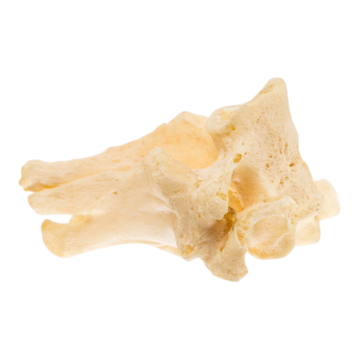 Real Human Cervical Vertebrae - Fused