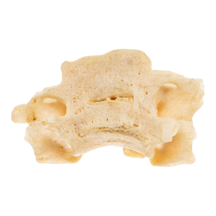 Real Human Cervical Vertebrae - Fused