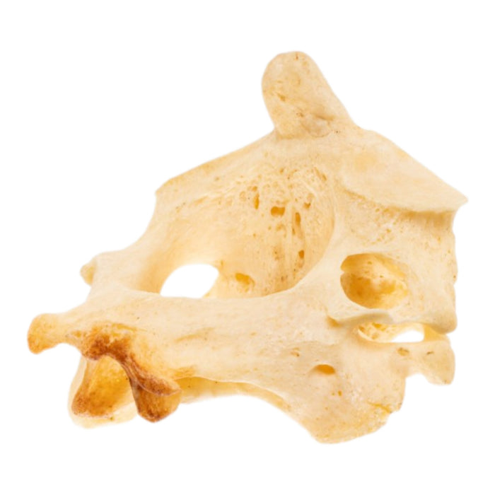 Real Human Cervical Vertebrae with Axis - Fused