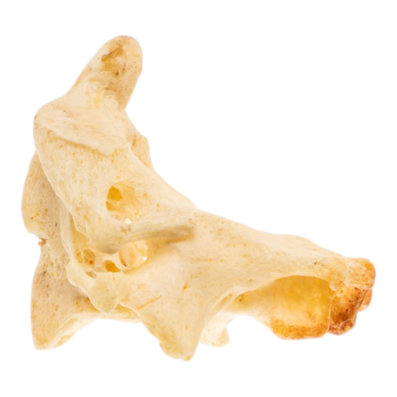 Real Human Cervical Vertebrae with Axis - Fused