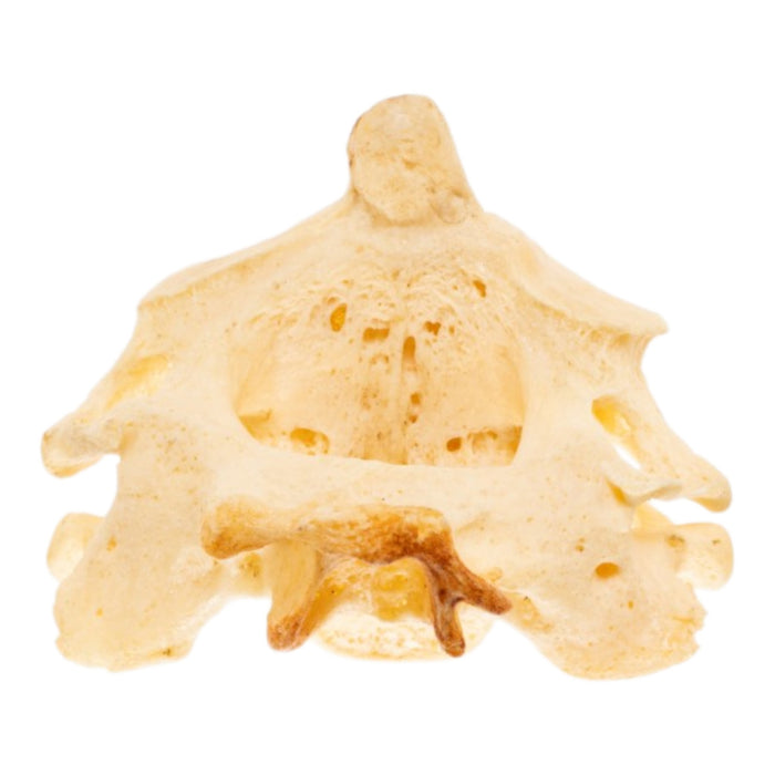 Real Human Cervical Vertebrae with Axis - Fused