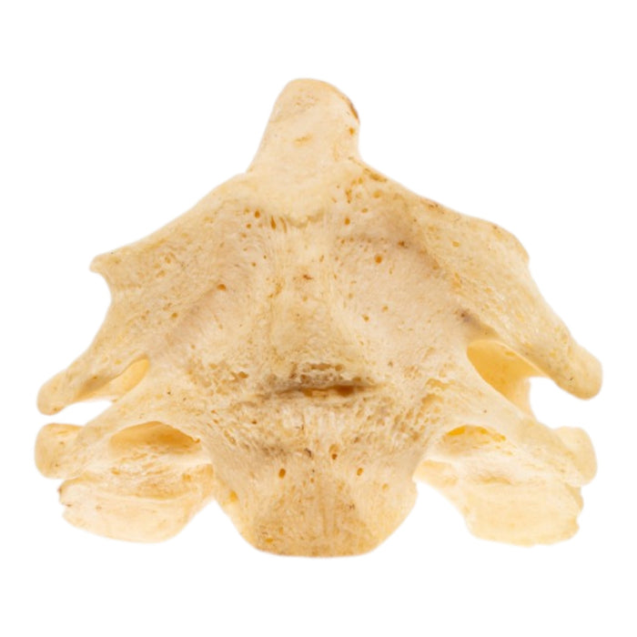 Real Human Cervical Vertebrae with Axis - Fused