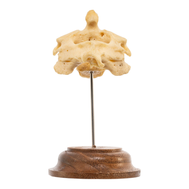 Real Human Cervical Vertebrae with Axis - Fused
