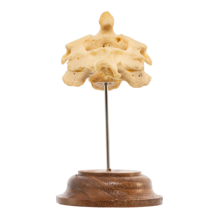 Real Human Cervical Vertebrae with Axis - Fused