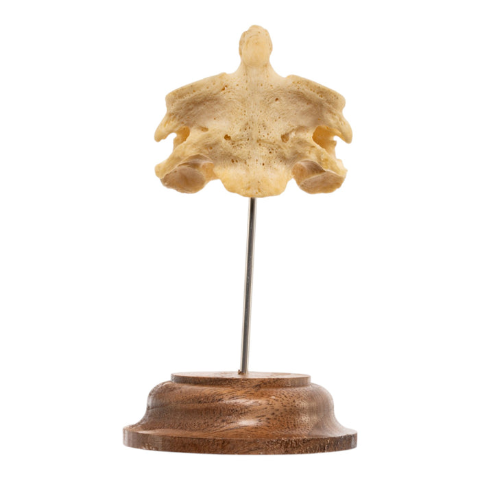 Real Human Cervical Vertebrae with Axis - Fused