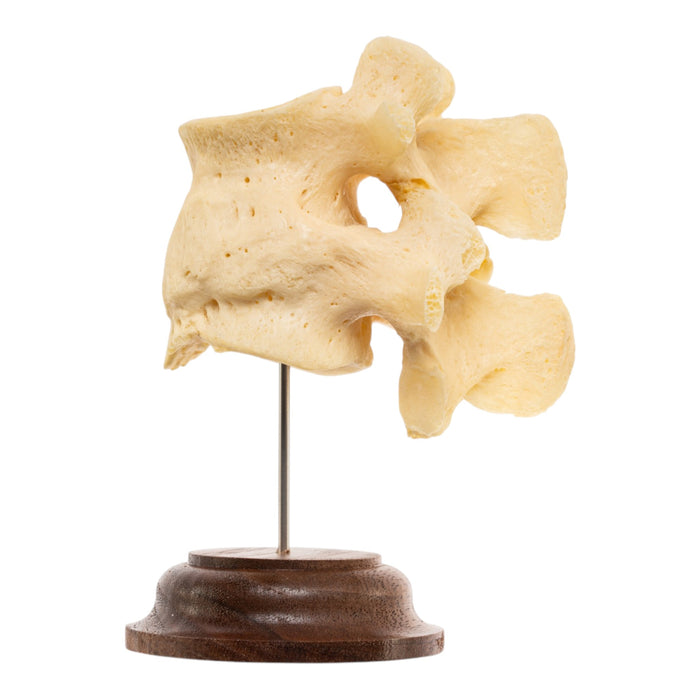 Real Human Lumbar Vertebrae - Fused