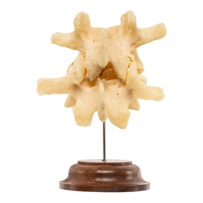 Real Human Lumbar Vertebrae - Fused